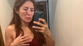 Exdeportista mexicana denuncia agresiones físicas de su pareja