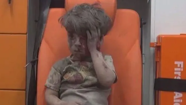 Omran Daqneesh, sentado en una banca tras ser rescatado