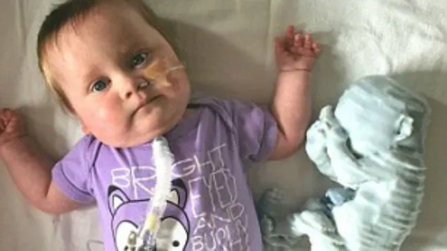 Kieran posa en una foto junto a un molde 3D de su ultrasonido