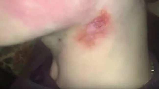 La marca en el cuello del joven