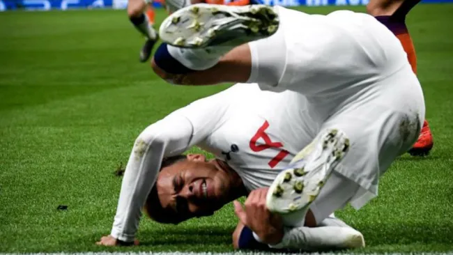 Dele Alli sufre caída en el partido de Champions