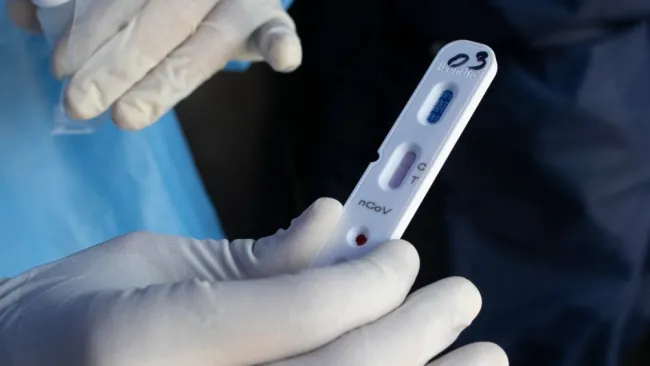 Prueba rápida de coronavirus que da negativa en Venezuela