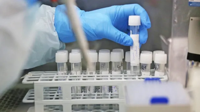 Coronavirus: Hallaron 'superanticuerpo' capaz de combatir todas las variantes del covid-19