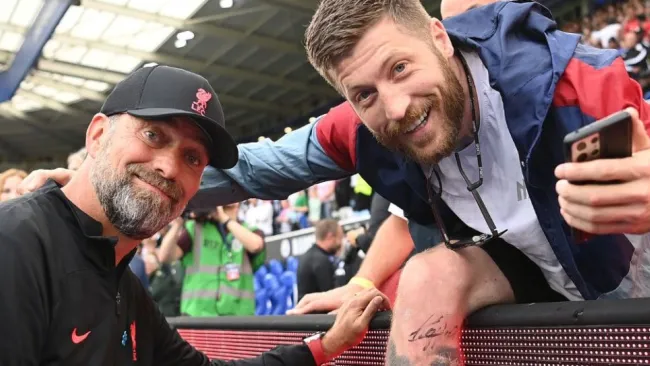 Jürgen Klopp tras firmarle la pierna al aficionado
