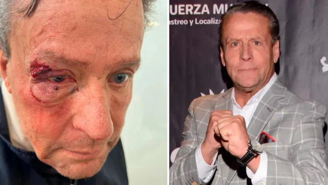 Alfredo Adame, víctima de agresión