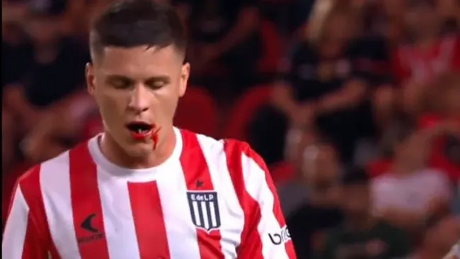 Guido Carrillo tras perder tres dientes por un codazo de su rival