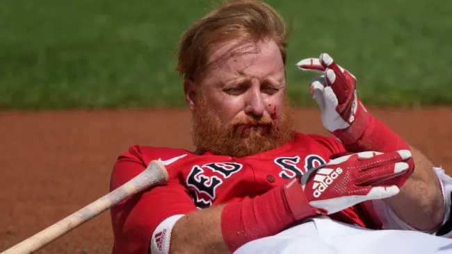 Justin Turner recibió un bolazo en el rostro