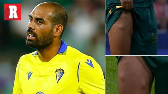 Fali: La impactante lesión que ocurrió en el Atlético de Madrid vs Cádiz