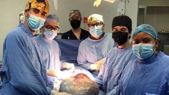 Médicos del IMSS retiran tumor de 21 kilos a señora de 60 años