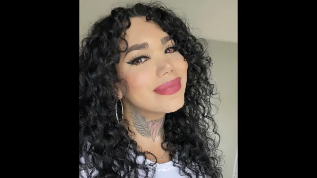 La salud de la influencer ya está mejor, pero aún presenta problemas en su ojo.