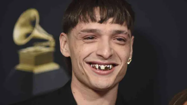 ¿Está chimuelo? Peso Pluma sorprende con su dentadura de oro en los Premios Grammy 