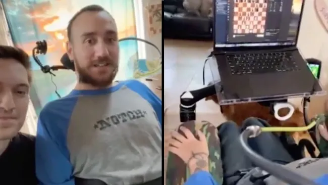 Noland Arbaugh es el paciente número 1 de la empresa.