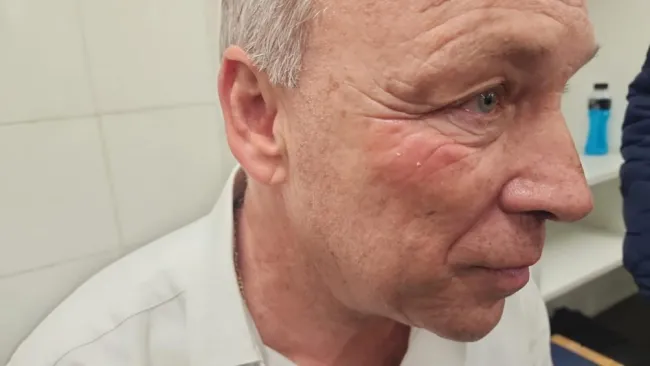 Hijo de Andrés Fassi comparte primeras imágenes del golpe recibido por árbitro argentino