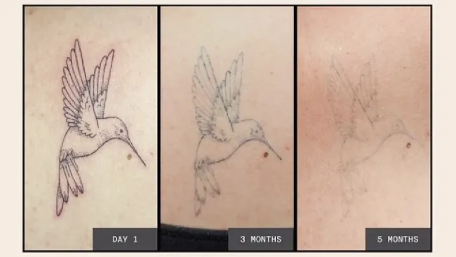 Los diseños se realizan sobre las capas altas de la piel.