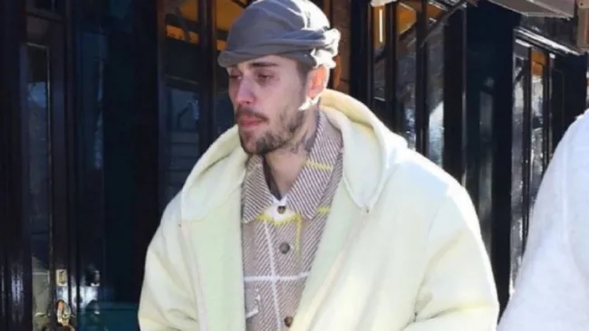 Justin Bieber, el cantante ha preocupado a sus seguidores por su apariencia