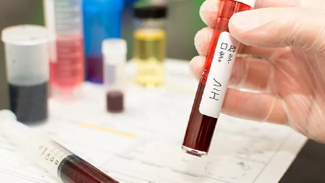 UNAM abre consultorio gratuito para prevenir el VIH 