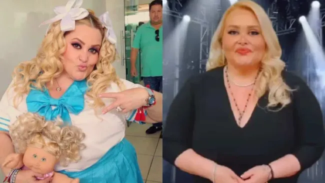 Así luce Sheyla, comediante que bajó más de 50 kilos y donó su piel a pacientes graves