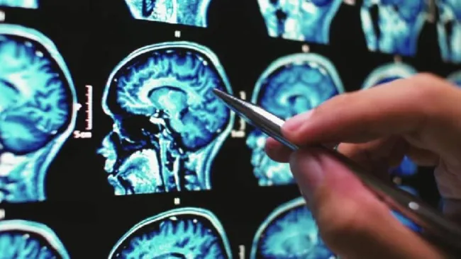 La pandemia envejeció tu cerebro más rápido, incluso si no te contagiaste, según estudio