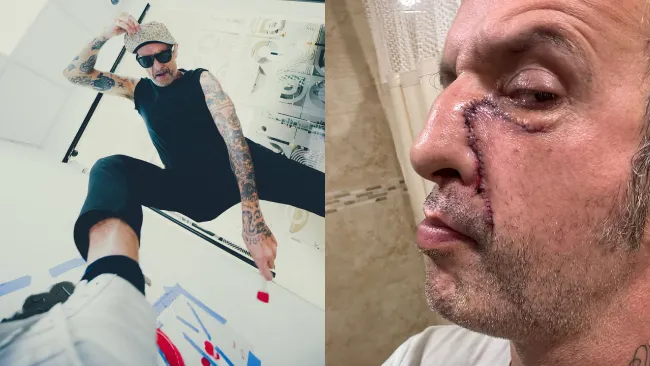 El músico dejó su banda para poder recuperarse de sus adicciones.