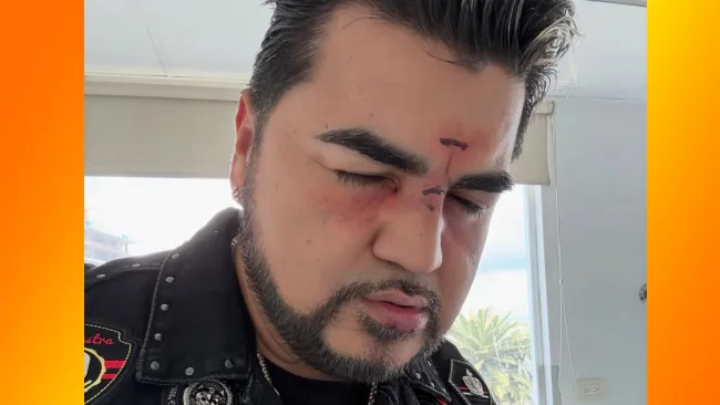 El cantante agradeció al doctor que lo atendió por sus heridas.