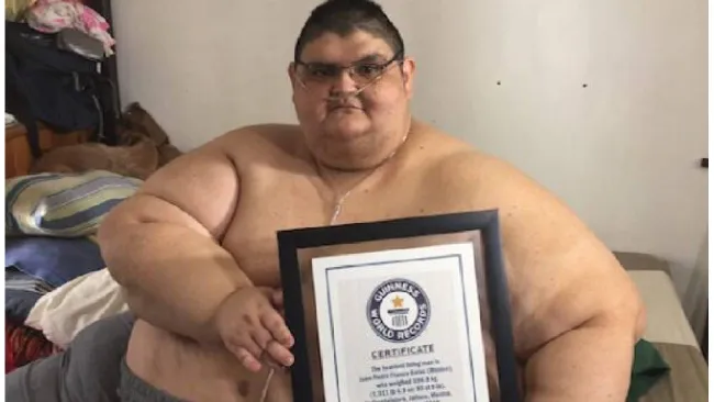 Muere Juan Pedro Franco a los 41 años, el hombre más obeso del mundo originario de México