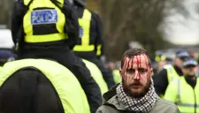 Un aficionado sangra mientras elementos policiales entran en acción