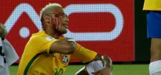 Neymar, ensangrentado tras el codazo de Duk