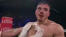 Omar Chávez terminó con un ojo morado tras derrota con Ortíz