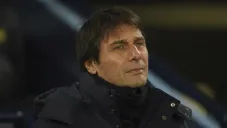 Antonio Conte: DT del Tottenham será operado de la vesícula