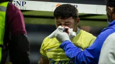 Zendejas sufrió un corte y tuvo que abandonar el partido