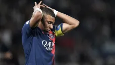 Mbappé es acusado de no cuidarse