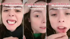 Maryfer Centeno sufre aparatoso accidente que casi la deja sin dientes