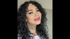 La salud de la influencer ya está mejor, pero aún presenta problemas en su ojo.