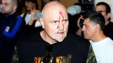 Padre de Tyson Fury sobre el cabezazo a miembro del equipo de Usyk: 'Era un tipo irrespetuoso'