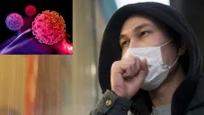 De los primeros síntomas está una infección en la garganta.