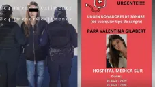 La modelo tuvo que ser llevaba a un hospital tras el ataque que sufrió.