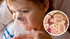 Tos ferina 2025: Aumentan los casos en el país