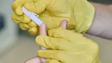 Pruebas gratuitas de VIH en CDMX: Ubicaciones y horarios