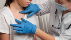 Secretaria de Salud confirma 362 casos de sarampión en México