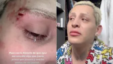 El creador de contenido dijo que logró escapar de sus agresores.