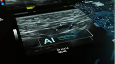 La inteligencia artificial mejora la detección del cáncer de mama en México, según la UNAM