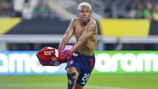 Costa Rica sufrió para vencer a República Dominicana