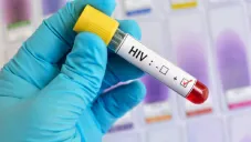 México rompe récord de contagios de VIH: 2025 supera todo el año pasado en solo 9 meses