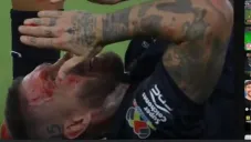 Así quedó Sergio Ramos tras el golpe de Lozano