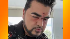 El cantante agradeció al doctor que lo atendió por sus heridas.