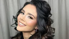 Milagro de Navidad: Dorismar presume su nueva nariz tras cirugía de reconstrucción