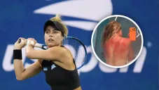 Las marcas del sol en la espalda de Renata Zarazúa durante la gira australiana