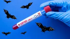 Virus Nipah en India confirman cinco casos cerca de Calcuta hay casi 100 personas en cuarentena