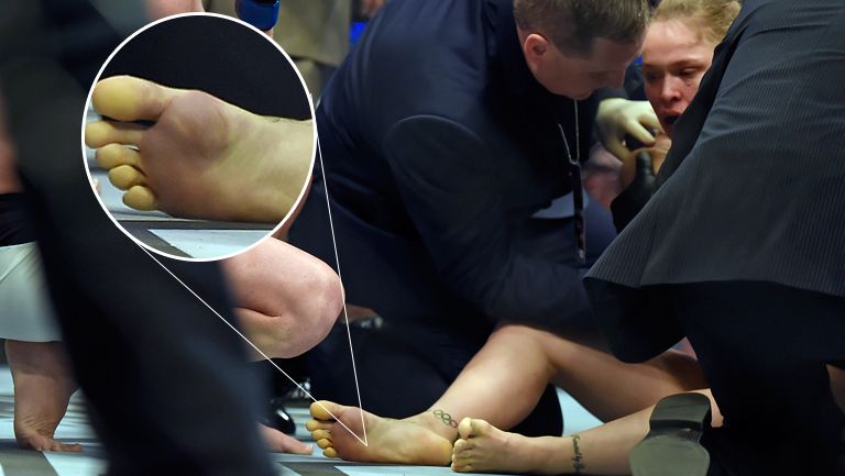 Pies de Ronda Rousey tras ser noqueada en UFC 183