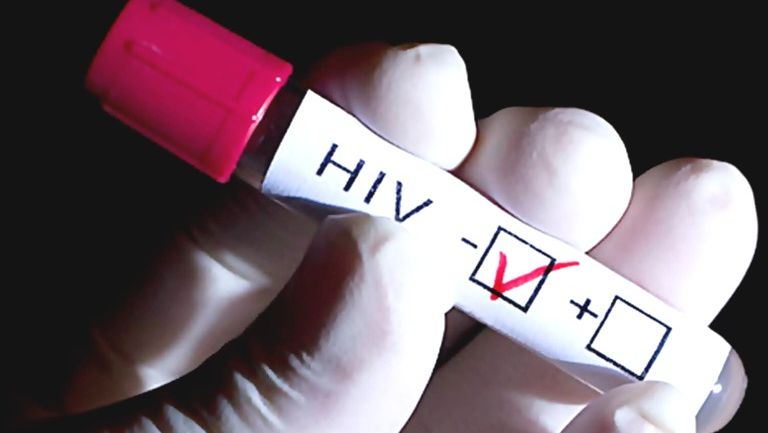 Virus de la inmunodeficiencia humana (VIH)